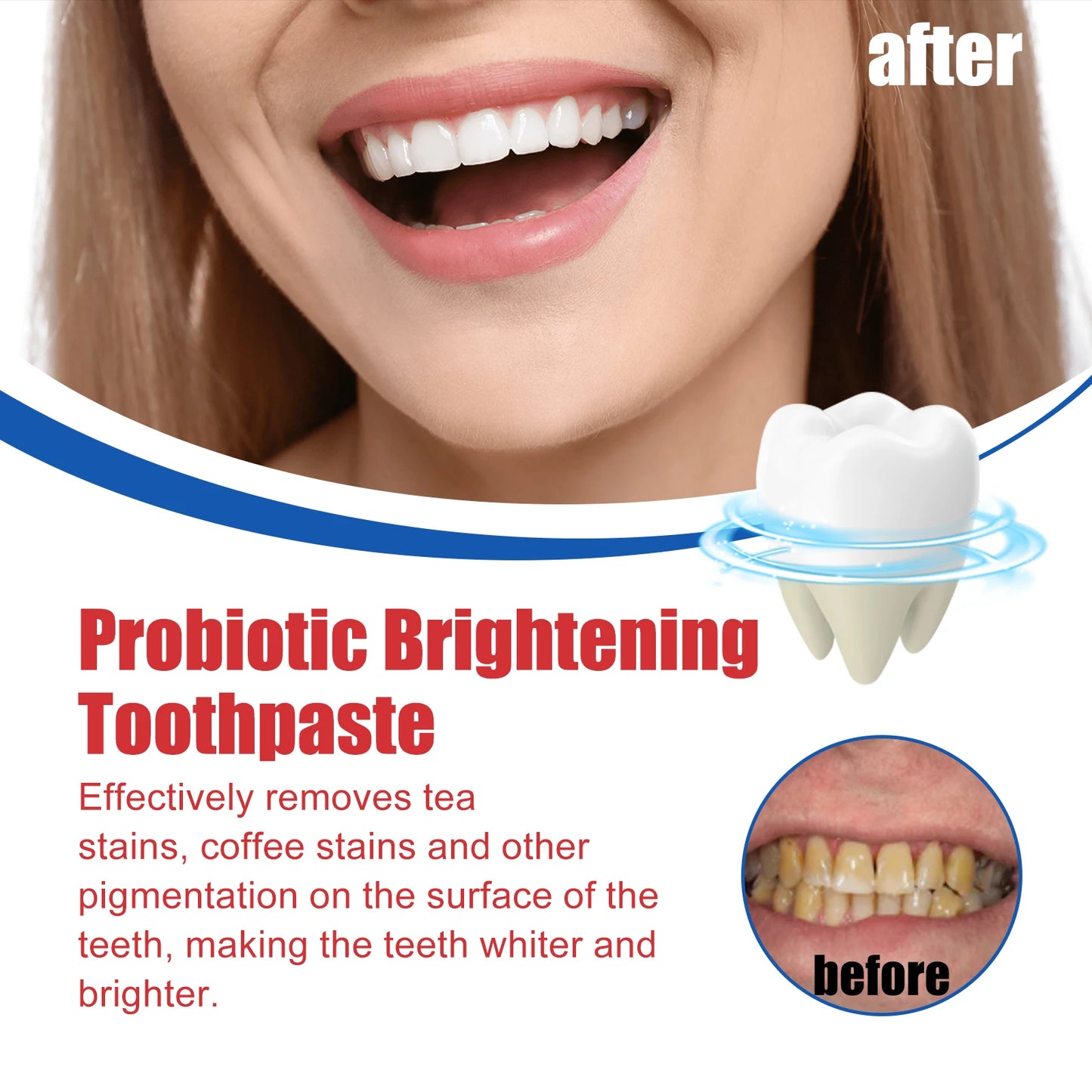 SP-6 Probiotic Brightening Toothpaste Oral Oral Hygiene Cleaning Odor Removal Fresh Breath Staining Removal Whitening Teeth Care